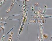 fitoplancton-organismos-da-agua-6