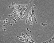 fungos-do-genero-penicillium-notatum-e-algumas-bacterias-1