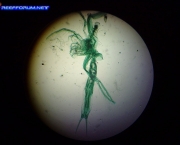plancton-caracteristicas-gerais-4