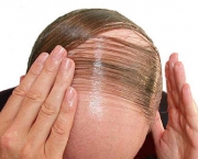 queda-de-cabelo-e-relacionada-a-poluicao-6