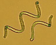 cianobacterias-4