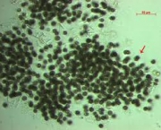 cianobacterias-5