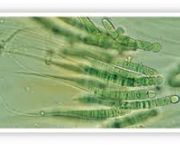 fotossintese-cianobacteria-2